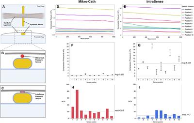 Sensor-Based Nerve Compression Measurement: A Scoping Review of Current Concepts and a Preclinical Evaluation of Commercial Microsensors